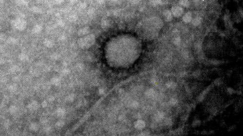 Coronavirus: la Quinta Sección superó los 5.000 casos activos