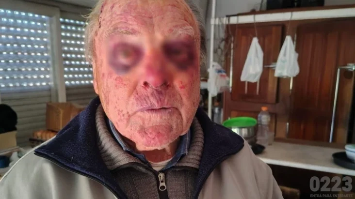 Asalto en pleno centro de Miramar: un jubilado de 90 años fue salvajemente golpeado y su familia pide que la causa sea caratulada como “tentativa de homicidio”